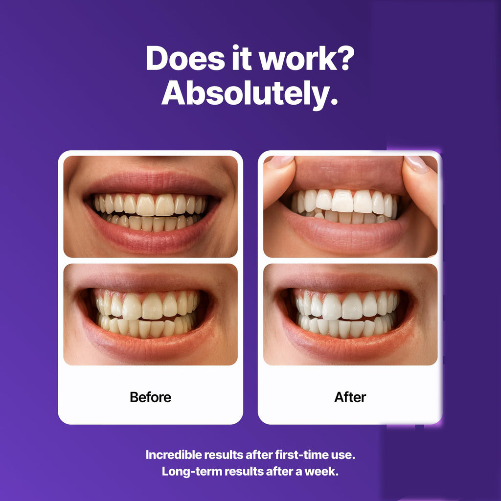 DRDENT Purple Teeth Whitening Strips