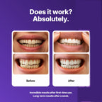 DRDENT Purple Teeth Whitening Strips