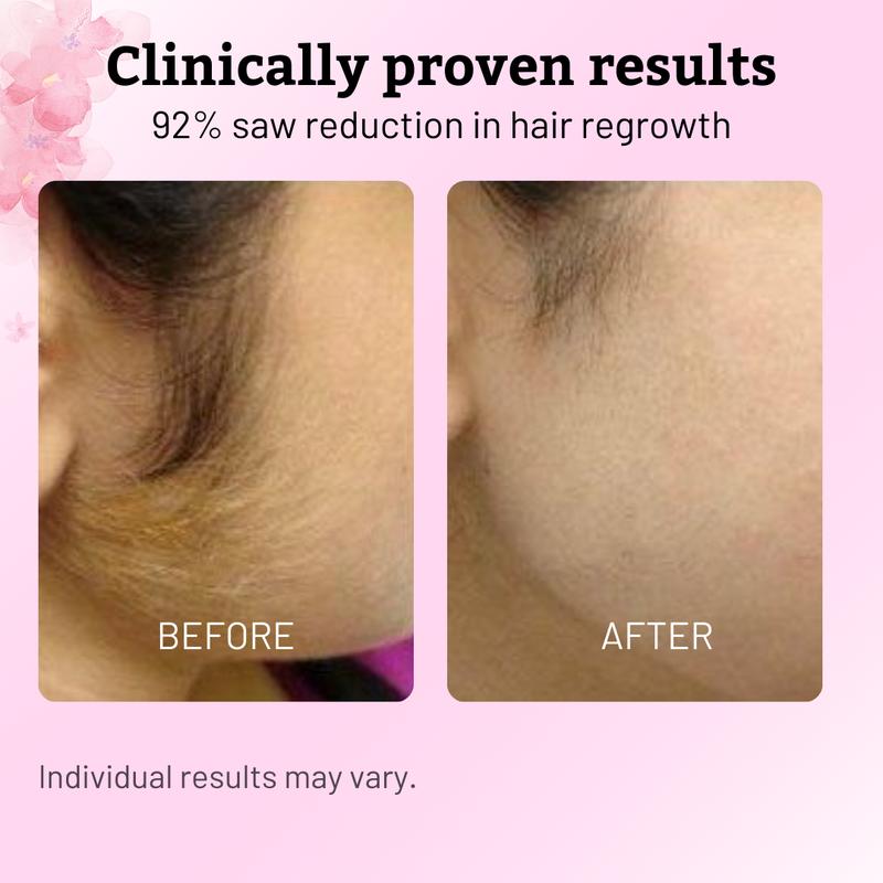Hair Removal Oil